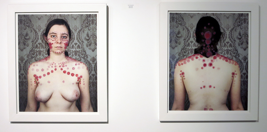 "Pain Map" by Suzi Grossman